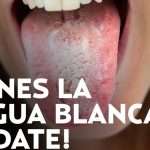 ¿Qué significa tener la lengua blanca? Posibles causas y soluciones
